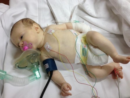 Baby with pyruvate kinase deficiency